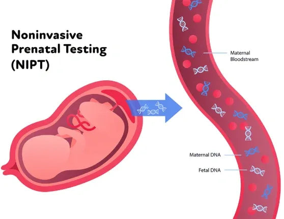 Test génétique prénatal non invasif + sexe