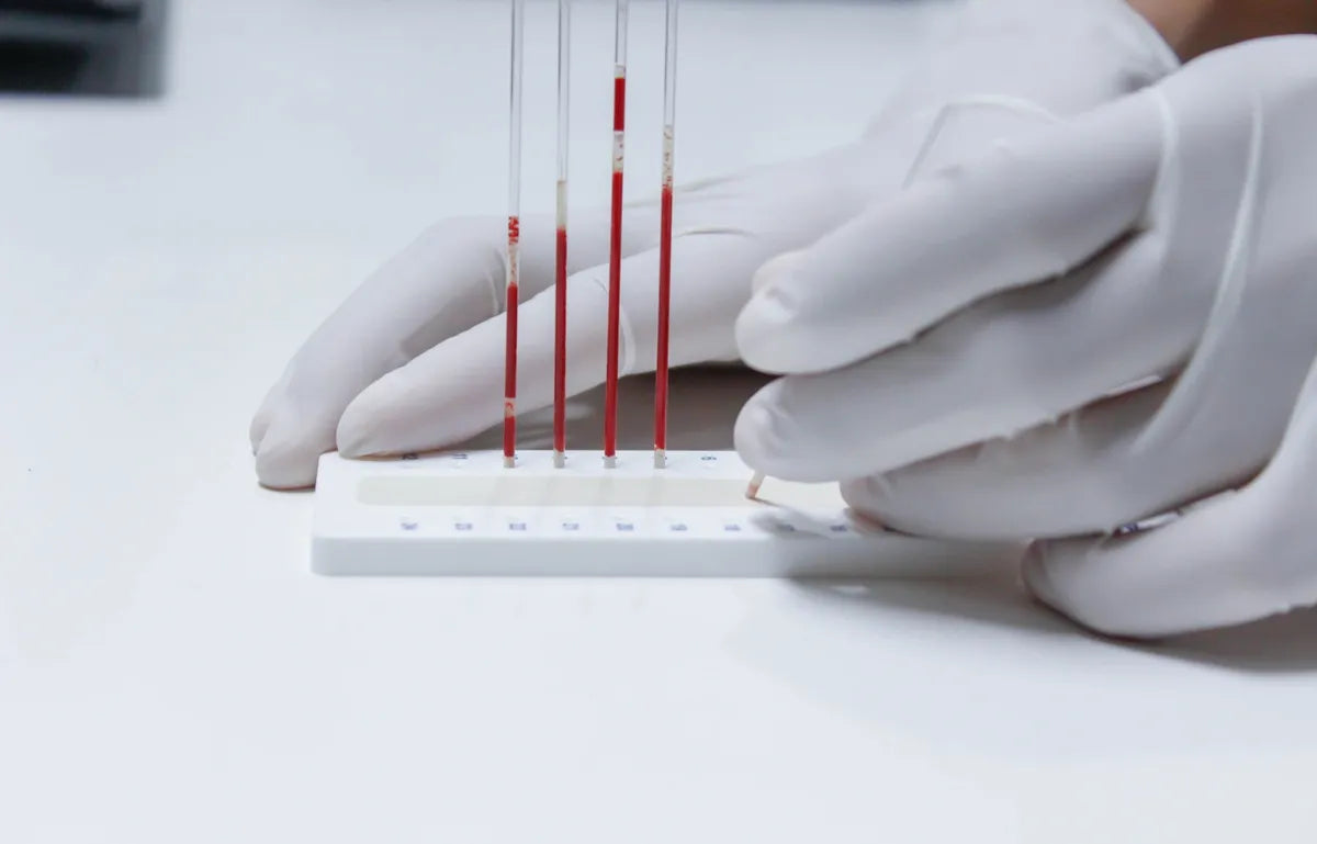 Xpert® FII & FV (includes Consultation with our partner health professional)