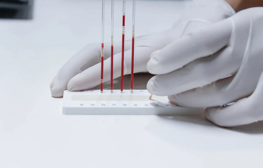 Xpert® FII & FV (includes Consultation with our partner health professional)